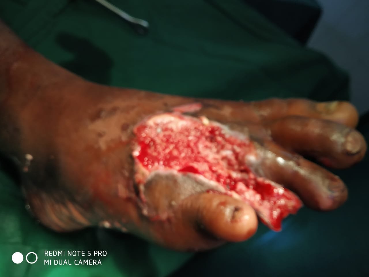 Before Surgery